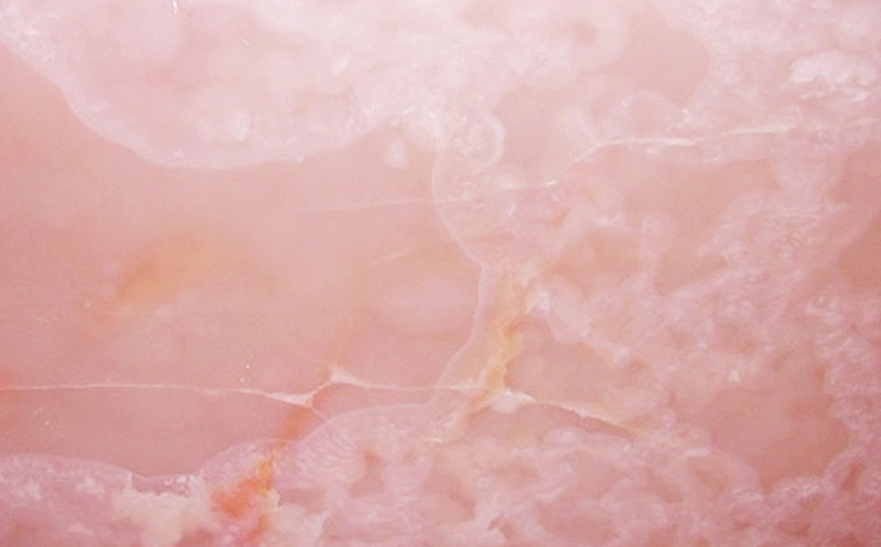 ONYX PINK